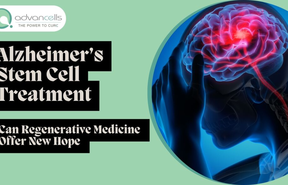 Alzheimers-Stem-Cell-Treatment